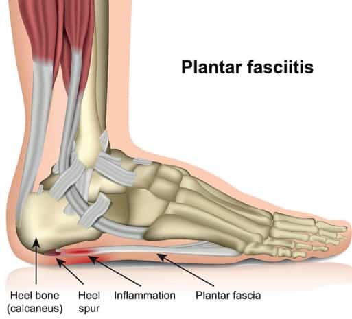 Campbelltown Physio, Physio Campbelltown, Physio Campbelltown, Physiotherapy Campbelltown, Physio Near Me, Physio Appt Today, Physio Open Now