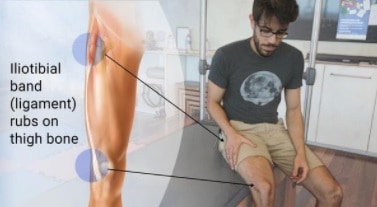 knee pain in runners, runners knee, illiotibial band syndrome, illiotibial tract, illiotibial, physio adelaide, adelaide physio, physiotherapy adelaide, physio near me