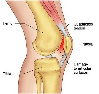 knee physiotherapy near me, physio for knee pain, physiotherapy for knee, sports physiotherapy, physio adelaide, adelaide physio, adelaide physiotherapy, physiotherapy adelaide