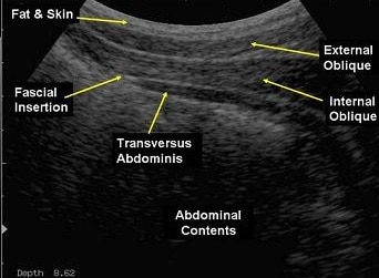 physio adelaide, adelaide physio, physiotherapy adelaide, adelaide physiotherapy, incontinence, pelvic floor exercises, pelvic floor dysfunction, pelvic floor therapy, core muscles, physio pilates, physio exercises, real time ultrasound,