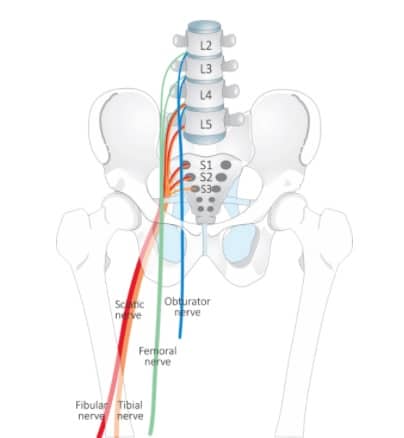 sciatica and physio, physio for sciatica pain, sciatica nerve physiotherapy, physio for sciatica nerve pain, will physio help sciatica, physiotherapy for sciatica, physio for lower back pain, low back pain and physio, lower back physio exercises, lower back physio, lower back physio, physiotherapy for hip pain, hip physio, physiotherapy for hip bursitis, physiotherapy and hips, physiotherapy for osteoarthritis, physio near me, physio appt today, physio open now