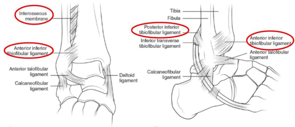 Ankle Syndesmosis, Ankle injury, Physio, Physiotherapist, Core Physio, Physio near me, Sports physio